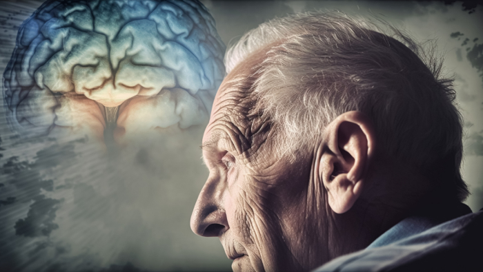 Alzheimer's Disease