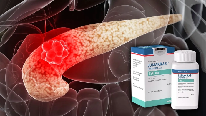 Lumakras-Vectibix Combo: FDA Approval for Colorectal Cancer - Featured Image