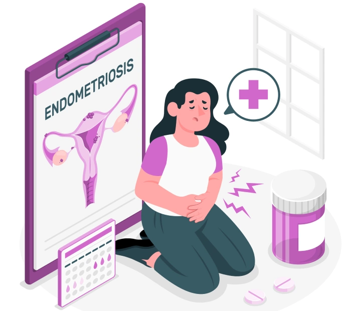 Visanne: un cambio radical en el tratamiento de la endometriosis - Featured Image